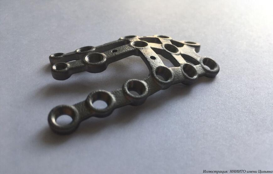 Новосибирские врачи установили 3D-печатный имплантат девочке с тяжелой деформацией стоп