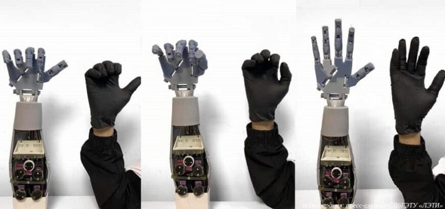 Петербургские ученые разработали умную перчатку для удаленной хирургии