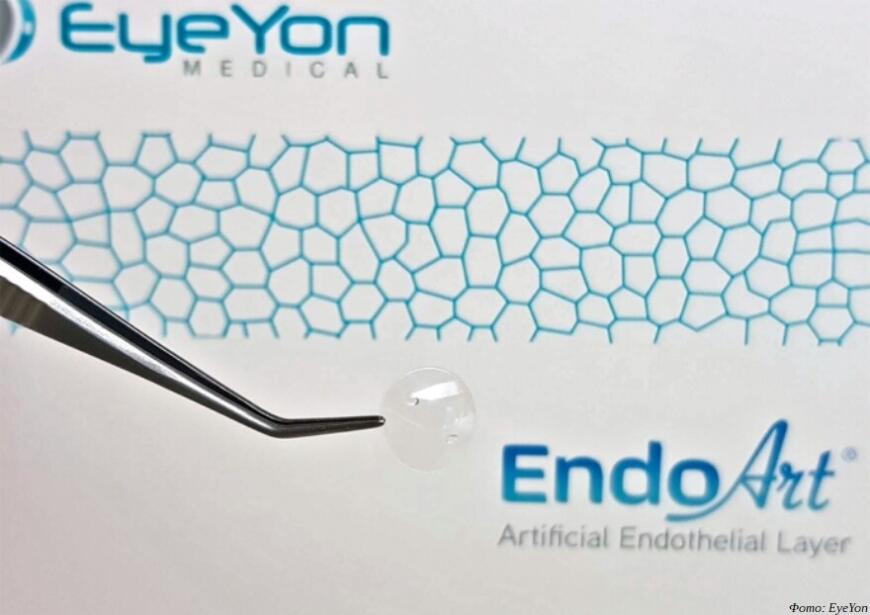 Израильские хирурги провели операцию по вживлению «самой тонкой» 3D-печатной роговицы в мире