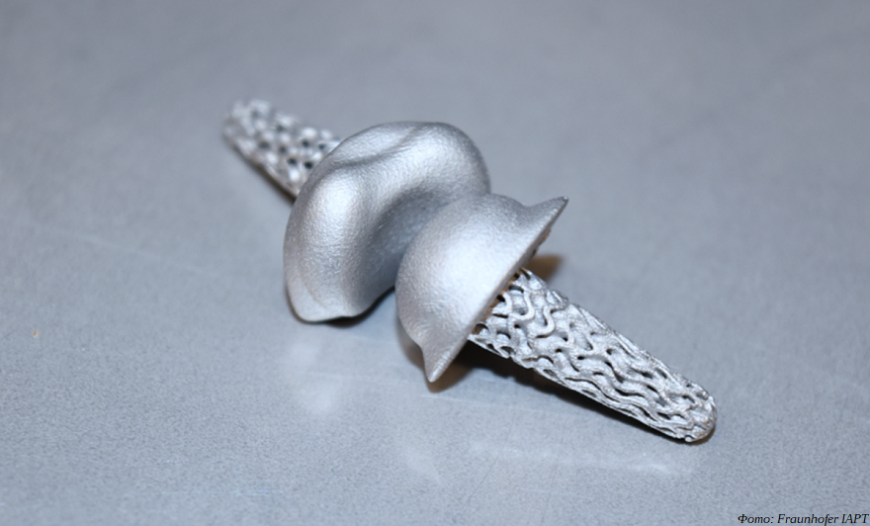 Немецкие ученые подключили искусственный интеллект к проектированию 3D-печатных протезов суставов