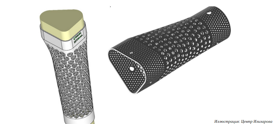 3D-печатный имплантат отмечен золотой медалью выставки «Архимед-2023»