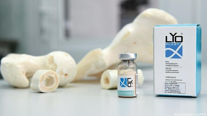 СамГМУ представил наработки по медицинской 3D-печати на форуме «Ради жизни»