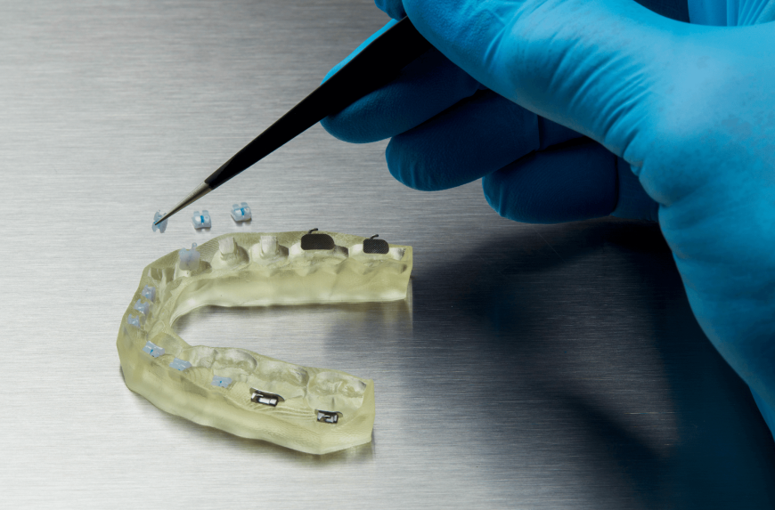 Новый фотополимер Formlabs — IBT Resin. Ускоренная и упрощенная установка брекетов.