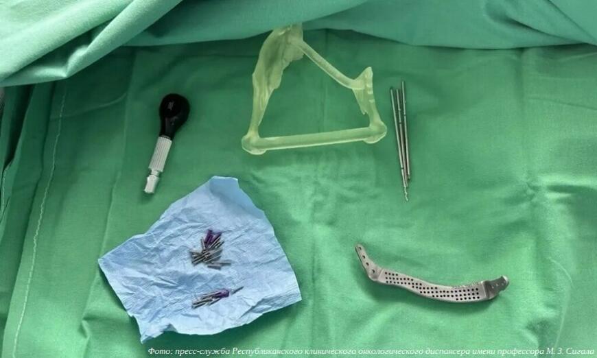 Казанские онкологи заместили пораженный опухолью участок челюсти 3D-печатным эндопротезом