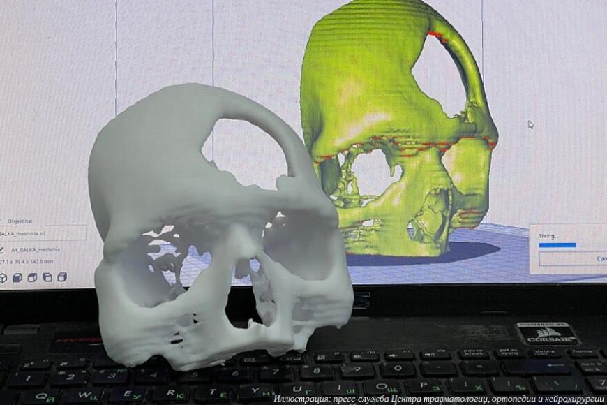 Кировские врачи поделились опытом применения 3D-технологий