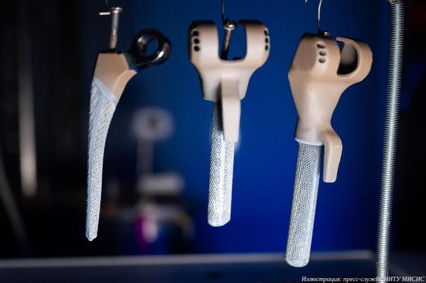 Ученые НИТУ МИСИС разработали антибактериальное покрытие для 3D-печатных титановых эндопротезов