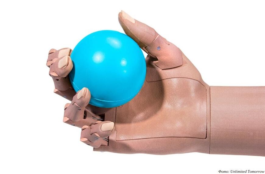 TrueLimb: 3D-печатные бионические протезы от Unlimited Tomorrow