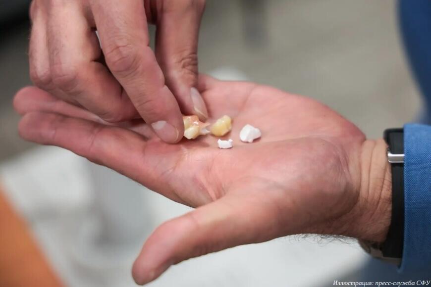 Красноярские ученые создают полуфабрикаты для производства зубных имплантатов и искусственных суставов