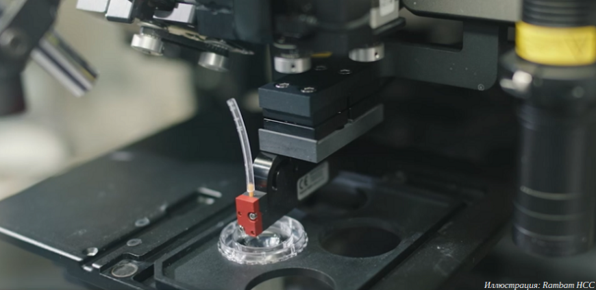 Израильские врачи вернули слепой пациентке зрение с помощью 3D-печатной роговицы