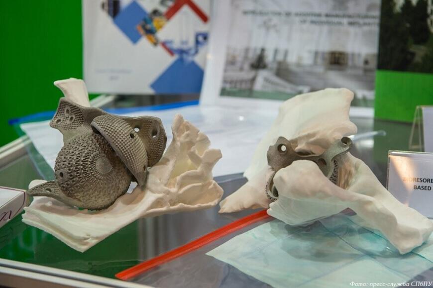 Специалисты СПбПУ разработали программу для 3D-печати биметаллических эндопротезов
