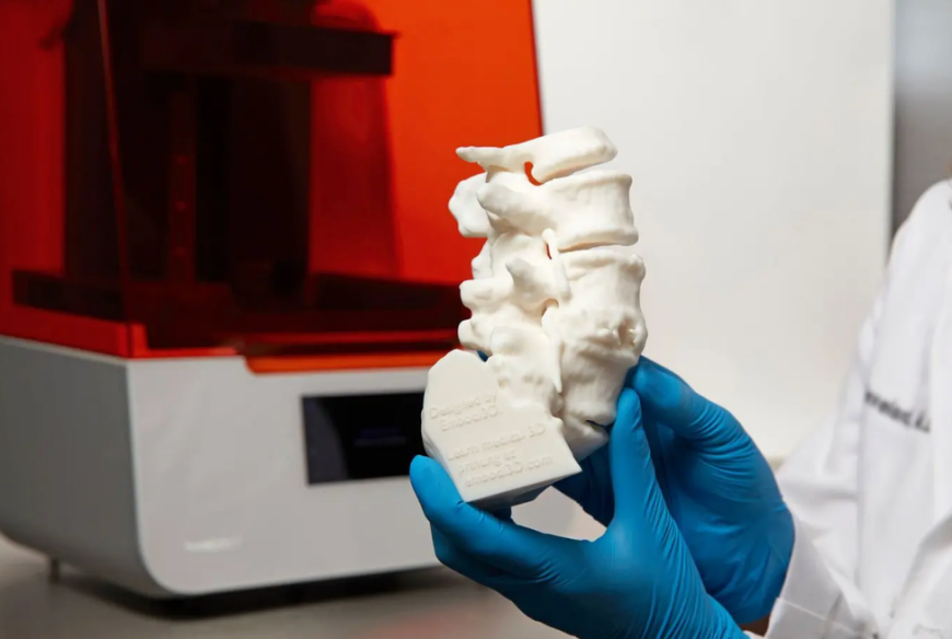 Как сейчас используется 3D-печать в хирургии позвоночника