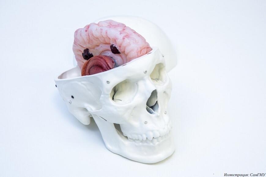 Самарские ученые создали 3D-печатный макет мозга