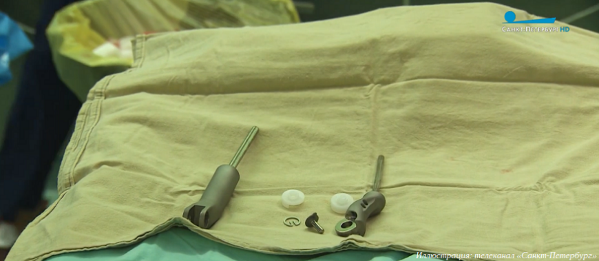 Петербургские хирурги заменили локтевой сустав пациента 3D-печатным эндопротезом