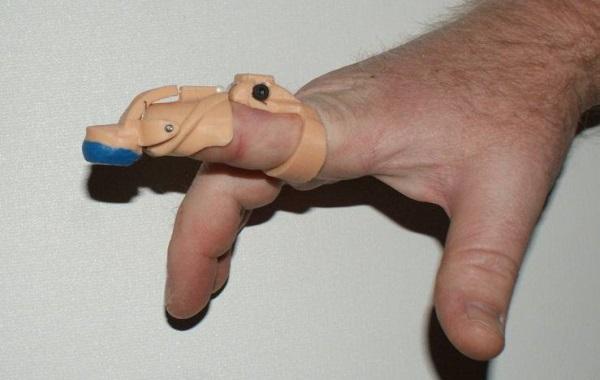 3D-печатный протез кончика указательного пальца на руке Колла