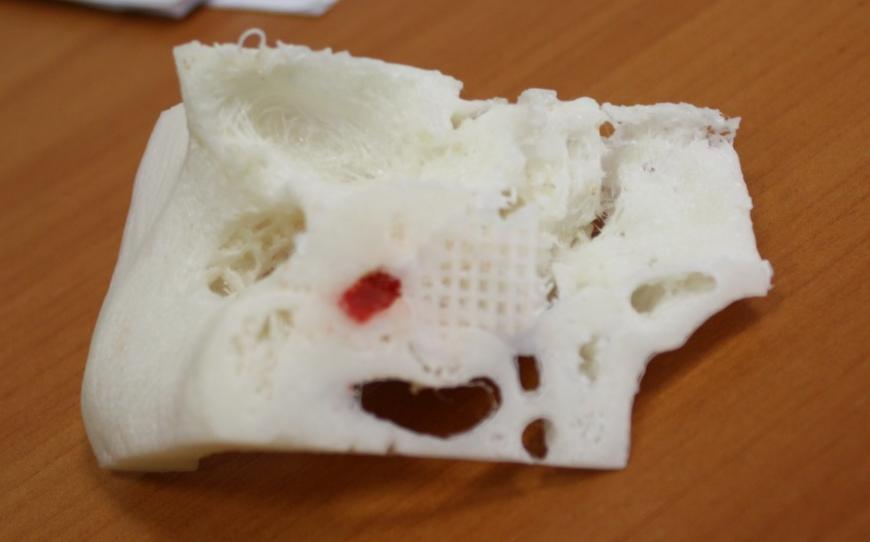 Как 3D-печать помогает изучать височную кость