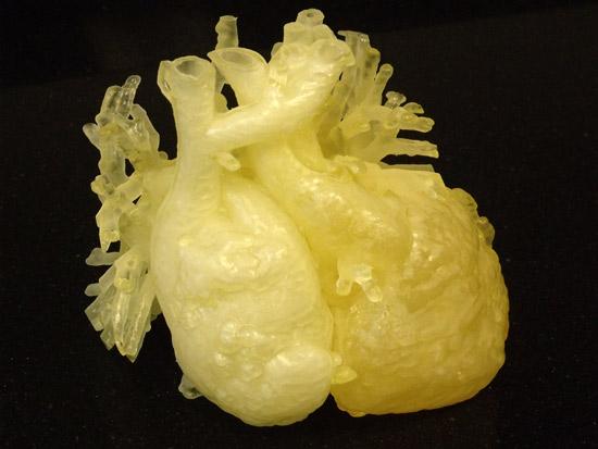 3D печать сердца помогла хирургам  выполнить сложную операцию.