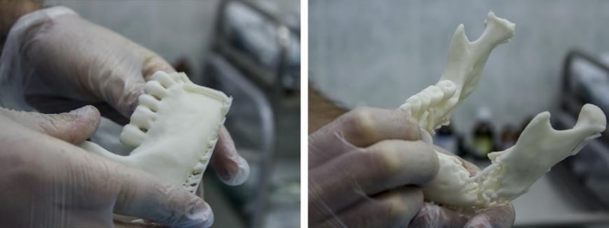 3D печать в челюстно-лицевой хирургии