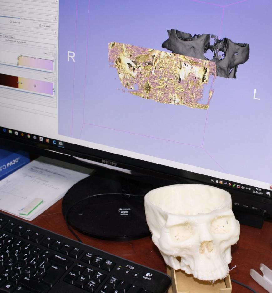 Как 3D-печать помогает изучать височную кость