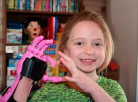 Онлайн сообщество создало 3D-печатную руку для 9-летней девочки