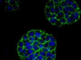 3D-печатные раковые ткани в качестве моделей для онкологических исследований