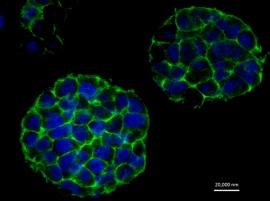 Исследователи используют трехмерную печать для создания моделей опухолей в лабораторных условиях