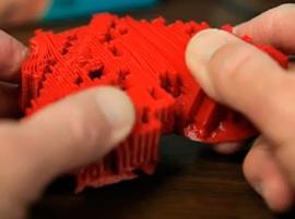 3D-принтер помог четырнадцатимесячному ребенку справиться с пороком сердца