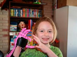 E-NABLE объединяет создателей, чтобы создать 3D-печатные протезы для нуждающихся