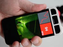 3D-печатный «Фотоплетизмограф» от Morpholio поможет нам лучше понять самих себя