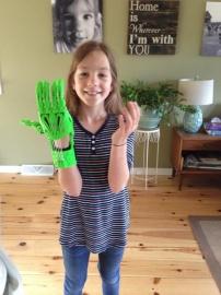 10-летняя девочка распечатала и собрала функционирующий протез руки