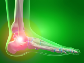 Женщине из Техаса установили протез лодыжки, напечатанный на 3D-принтере