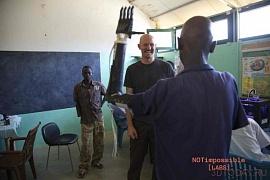 Проект «Даниэль» компании Not Impossible – напечатанные 3D-протезы для детей из Судана