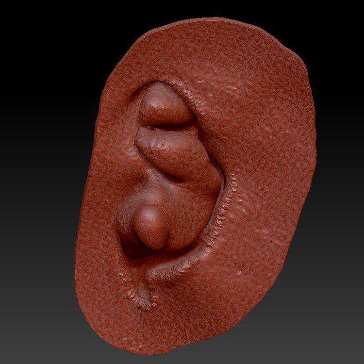 3d-модель имплантата ушной раковины