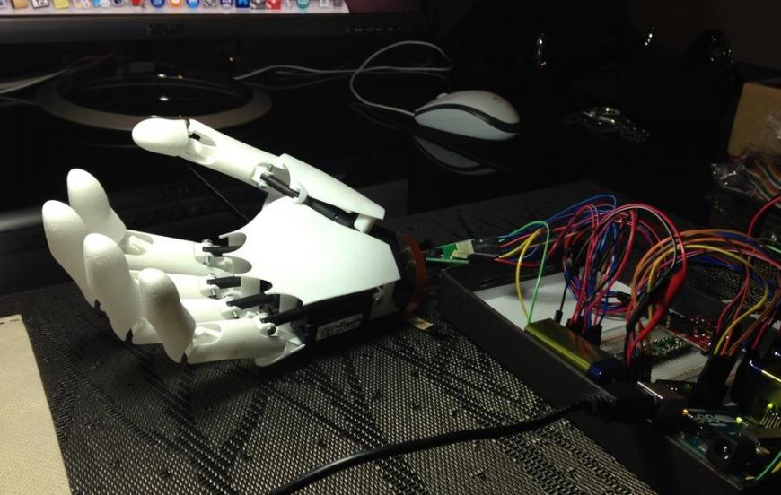 YouBionic – первый бионический протез руки, напечатанный на 3D-принтере