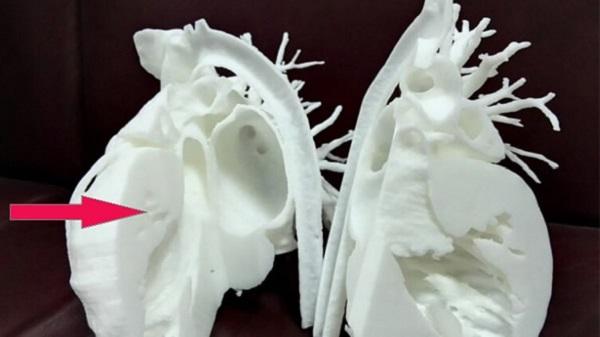 Вокруг света с 3Dtoday: 3D-печатные хирургические модели, 3D-принтеры для Формулы-1 и метаматериалы в стиле оригами