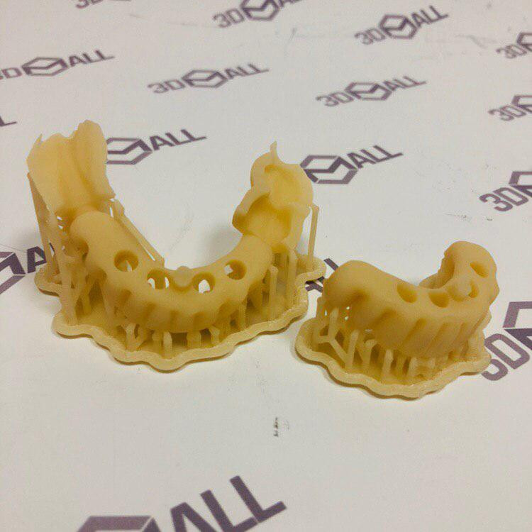 Временные коронки из фотополимера по технологии SLA