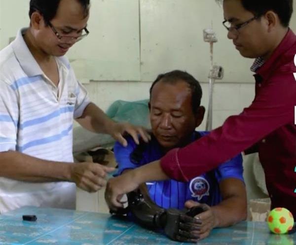 Вокруг света с 3Dtoday: прекращение производства 3D-принтеров Autodesk Ember, 3D-печатные протезы Victoria Hand в Камбодже и новый южноафриканский промышленный 3D-принтер