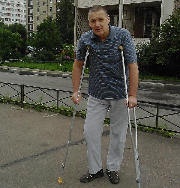 Петербургские врачи применяют аддитивные технологии в онкологическом эндопротезировании