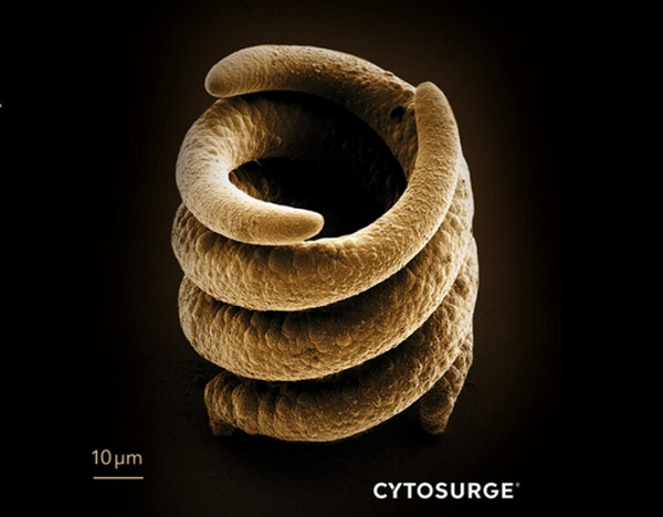 Компания Cytosurge разработала технологию субмикронной 3D-печати металлами