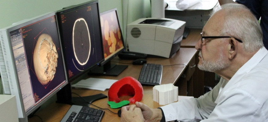 Пензенские хирурги внедряют технологии 3D-печати и 3D-моделирования