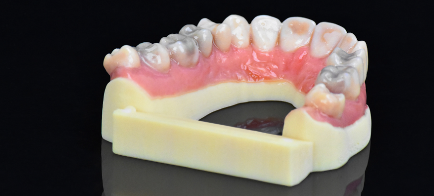 Stratasys анонсировала цветной стоматологический 3D-принтер J720 Dental