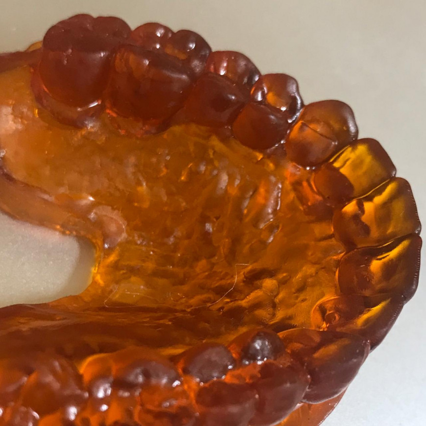 Зубы на стоматологическом принтере 3D Artel Zobu