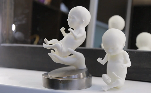 Уфимский стартап печатает на 3D-принтерах модели эмбрионов