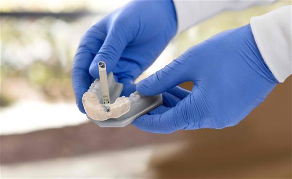 Formlabs представляет первую биосовместимую смолу Dental SG для цифровой стоматологии