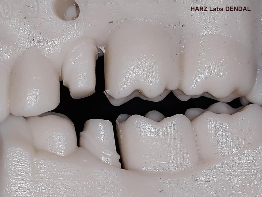HARZ Labs DENTAL SAND A1-A2 Пробная печать кусалок и жевалок. UNIZ PLUS