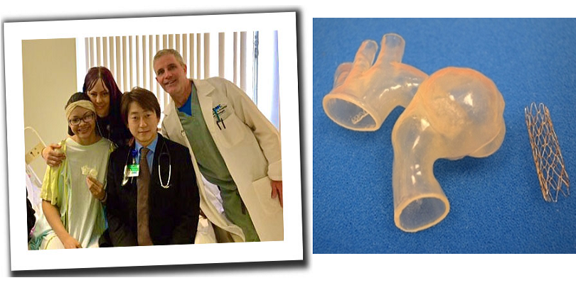3D-печатная модель сердца помогла хирургам успешно провести сложную операцию