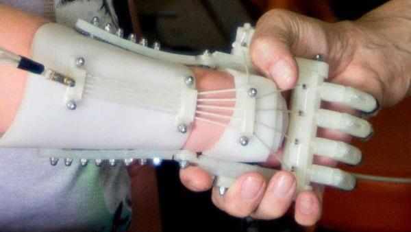Недорогой и удобный протез? С 3D-печатью это возможно!