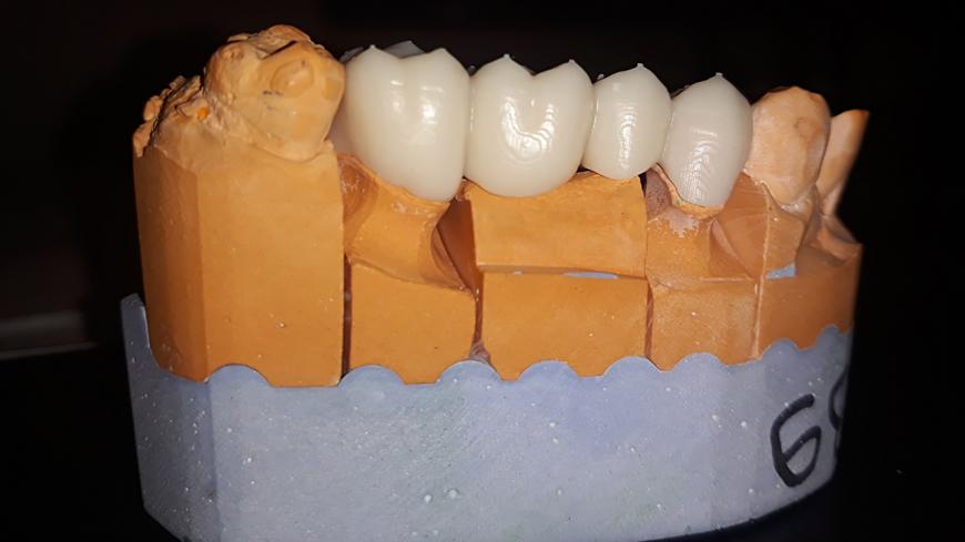 Модель для сборки, стоматологическая. UNIZ Slash PLUS HARZ LABZ Dental A1-A2, Yellow, Model Resin Grey