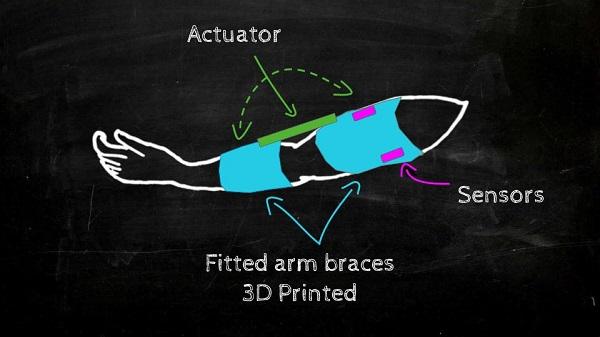 Отец и пятилетняя дочка разработали 3D-печатный бионический ортез