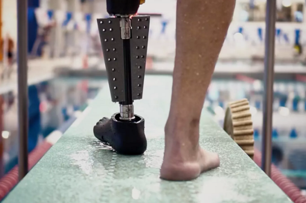 Northwell Health проводит клинические испытания 3D-печатных плавательных протезов