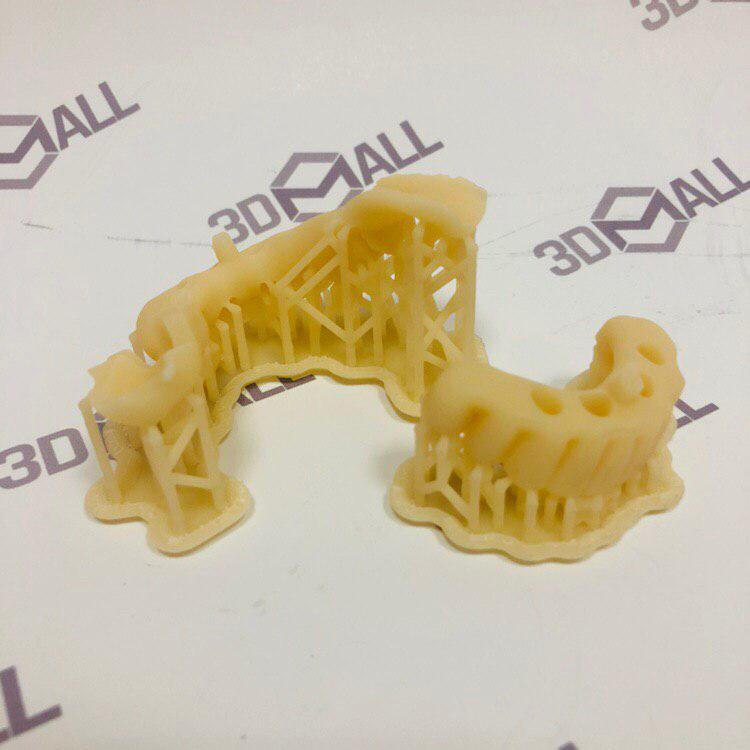 Временные коронки из фотополимера по технологии SLA